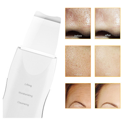 Kavitačný peeling Sonic Skin Scrubber 2W